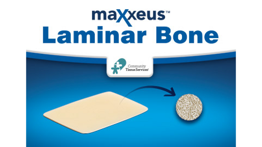 Maxxeus Laminar Bone