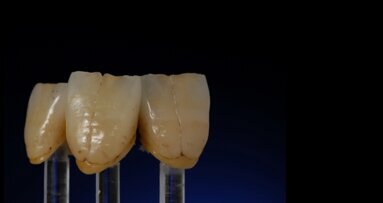 Technologia vs Sztuka