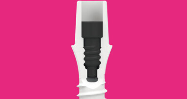 Dentalpoint AG announces FDA approval and U.S. sales of ZERAMEX P6