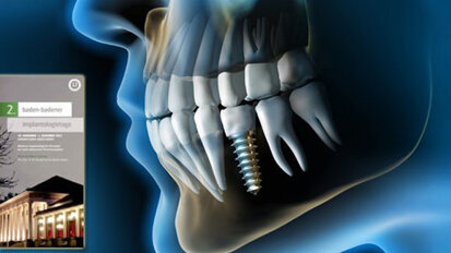 Konzepte bei stark reduziertem Knochenangebot