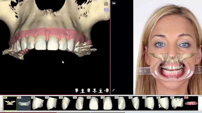 ¿Qué convierte a un Ortodoncista en Experto? (Parte II)