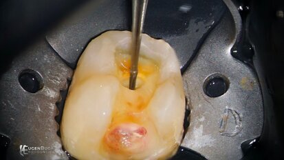 Guide to achieving fast and efficient precision in endodontics