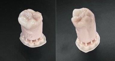 Printing crowns in less time than it takes to brew a cup of coffee