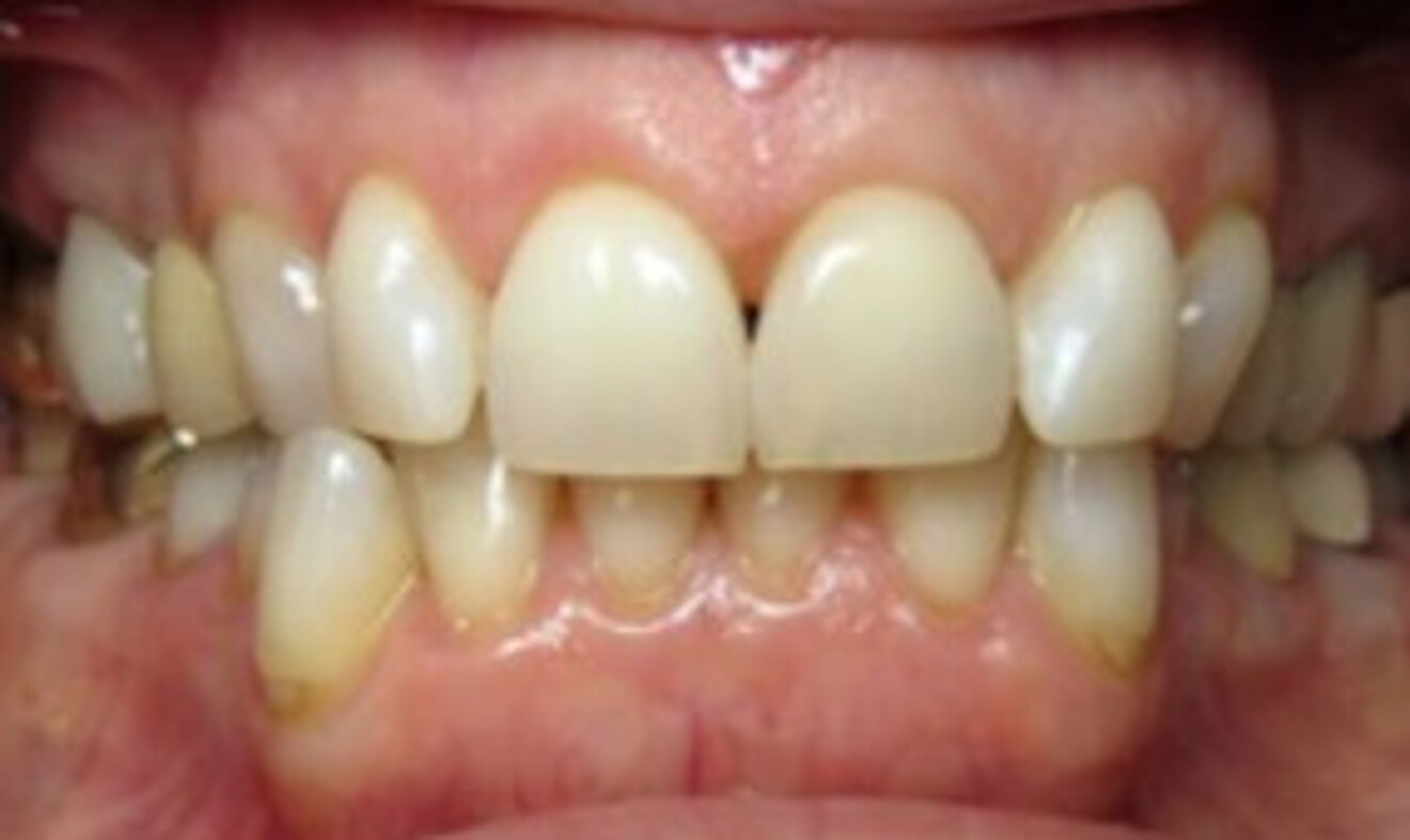 Fig. 9e: Before. 