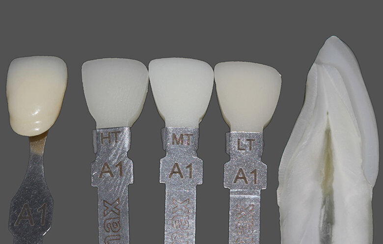 Fig. 1 Comparison of the different values of LT, MT and HT ingots; A1 shade tabs are used as reference here; however, the differences in value would be similar in conjunction with all A–D shades.