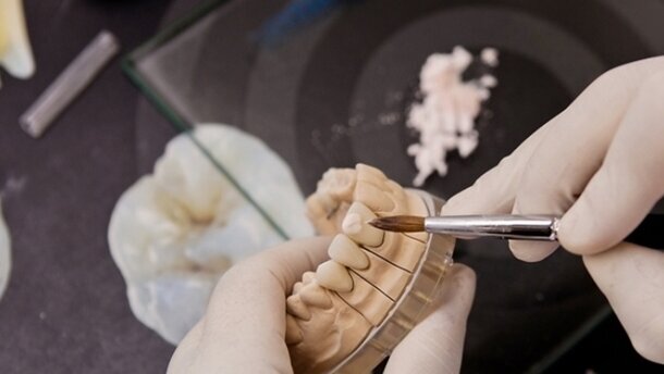 Diş Teknisyenleri Yıpranma Paylarını İstiyorlar