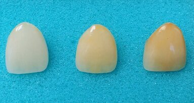 Las tres etapas de los dientes: Inocencia, madurez y sabiduría (1)