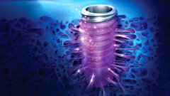 TS SOI gains ground in the European implant market