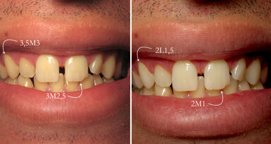 50 sombras de blanco