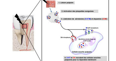 Découverte fondamentale sur le pouvoir naturel de réparation des dents