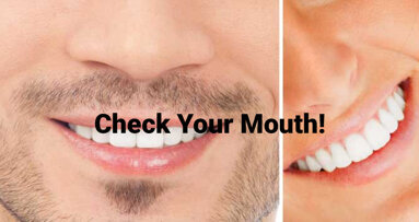 Dental hygienists promote early detection of oral cancer