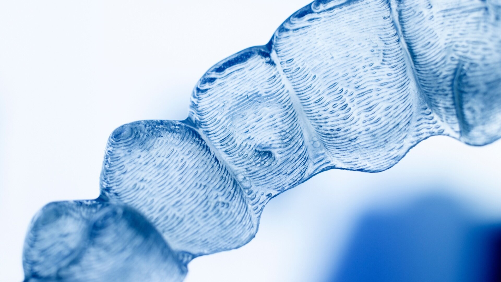 Vertical control in open bite correction using aligners and skeletal anchorage: A case series