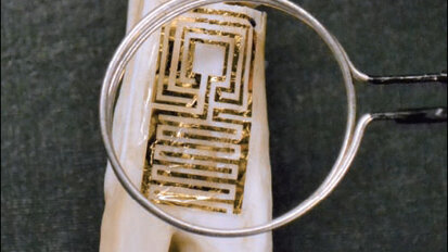 用于牙齿上的新型生物传感器