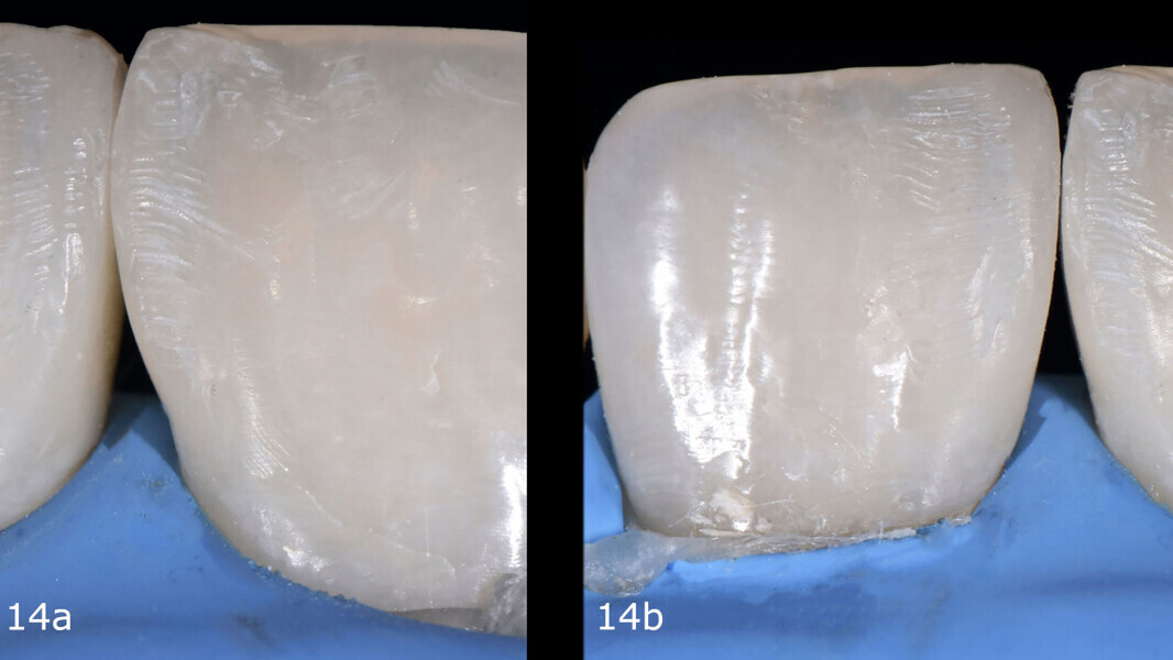 Figs. 14a & b: Control and smoothing of the marginal contour.