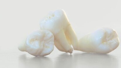 Armen verliezen acht tanden meer dan rijken