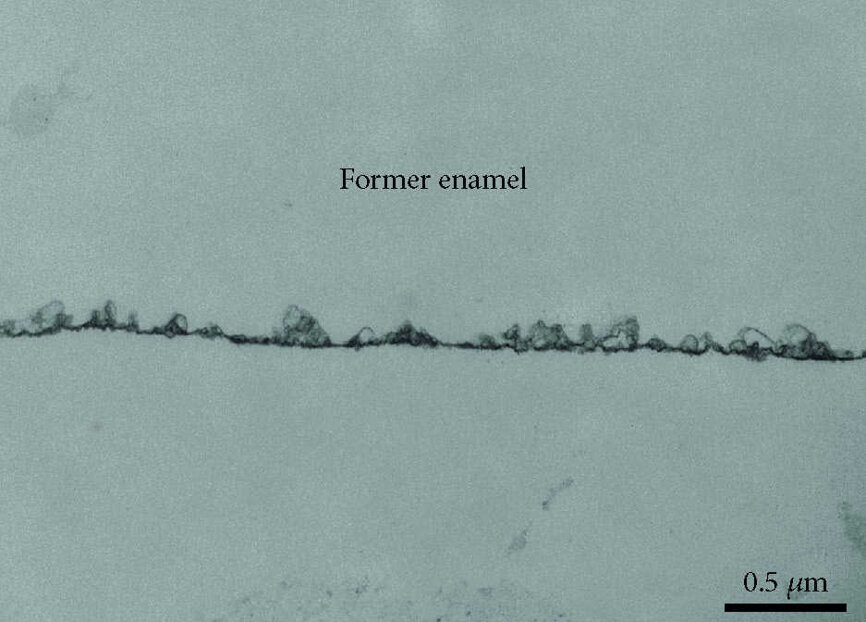 Fig. 9 : Micrographie MET à un grossissement de 30 000 fois montrant la présence de la pellicule formée après 30 minutes sur l’échantillon d’email rince avec une solution de HAP II. La pellicule apparait comme une couche continue et dense aux électrons. L’email a été dissous en raison de la déminéralisation des spécimens et n’est donc plus visible sur l’image MET.