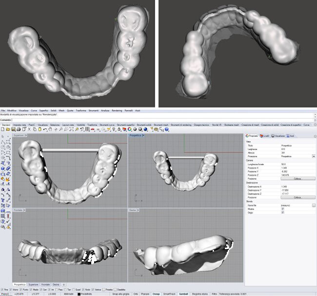 Fig. 10_Dispositivo dell’arcata inferiore.