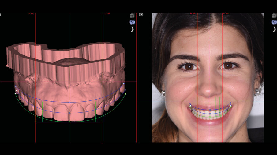 Figg. 5a-6b_Valutazione iniziale.