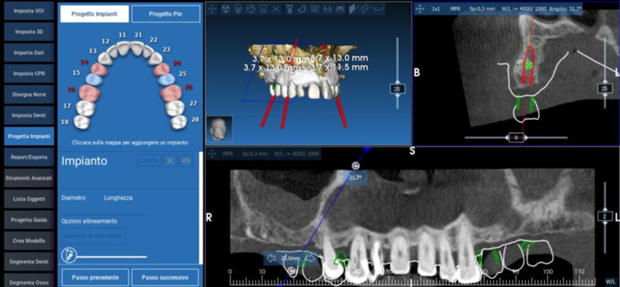 Figg. 15, 16_ Pianificazione con software Realguide.