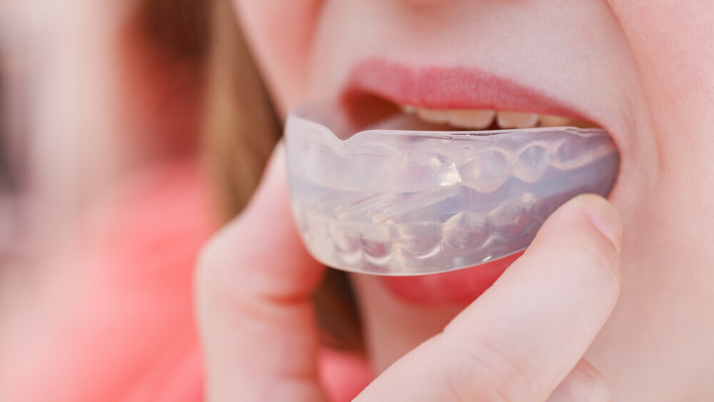 Researchers develop mouth guard for illuminating early signs of cavities