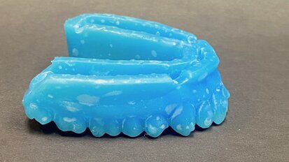 3D printing’s place in today’s dental practice