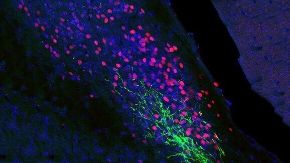 Toothaches: Why head and facial pain cause particular suffering