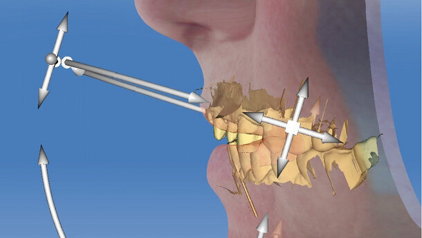 La projection esthétique : étape indispensable au tout numérique