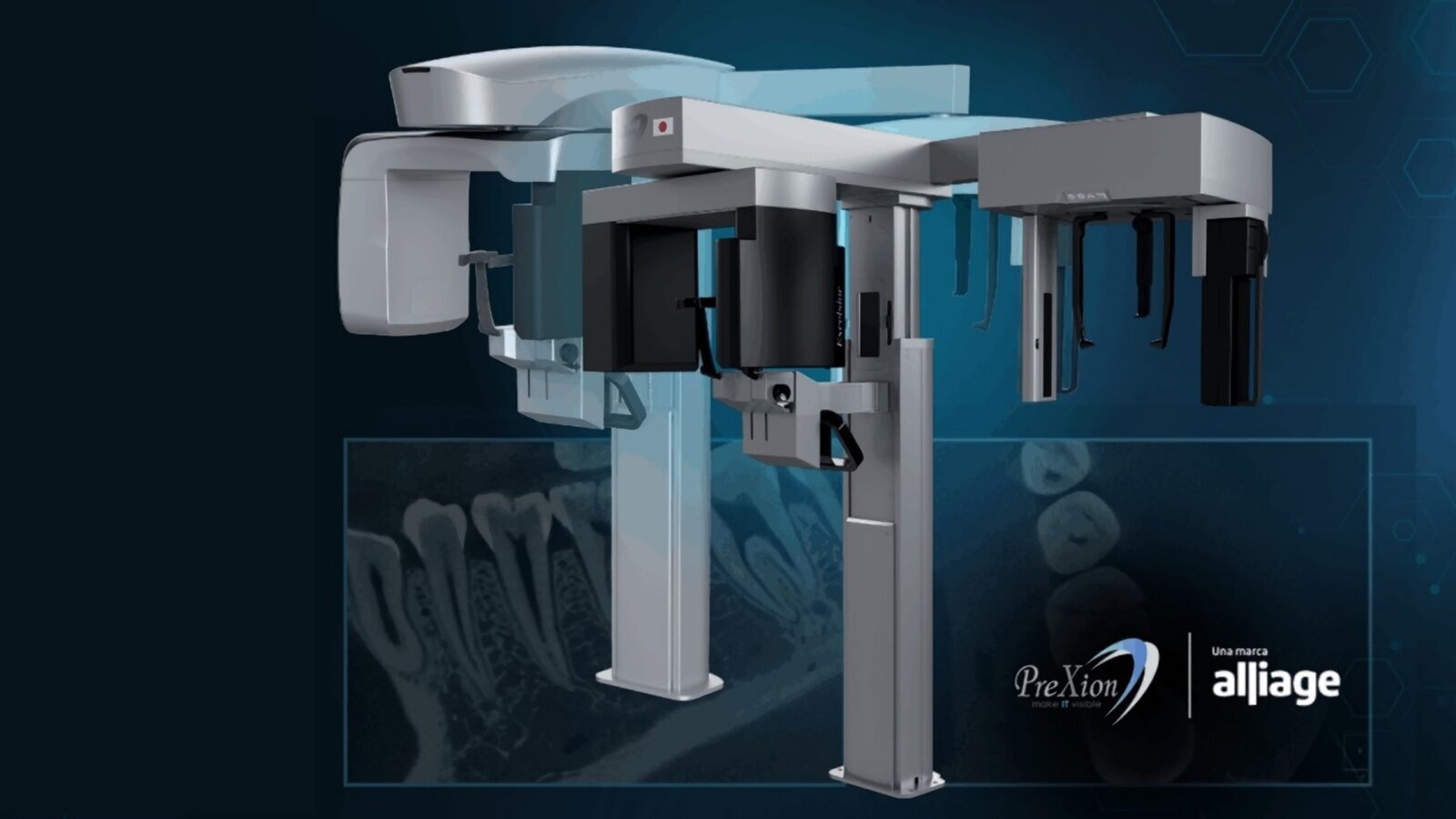 Alliage adquiere la empresa japonesa PreXion