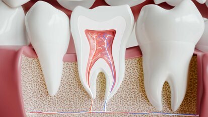 Update der S2k-Leitlinie zur Wurzelspitzenresektion