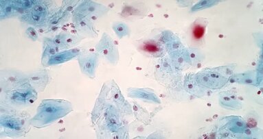 Изследователи от Обединеното кралство идентифицират бактерии, способни да унищожават рака на главата и шията