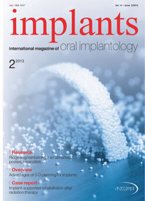 implants international No. 2, 2013 implants international No. 2, 2013