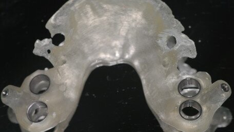 Le nuove tecnologie in implantoprotesi