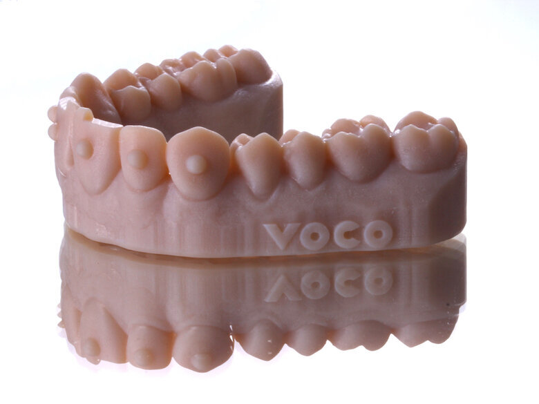 Fig. 17. Wax-up impreso en 3D.