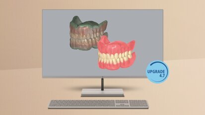Amann Girbach announces Ceramill update featuring new functions, greater capabilities