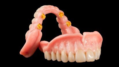 Candulor launches website for KunstZahnWerk competition Candulor launches website for KunstZahnWerk competition