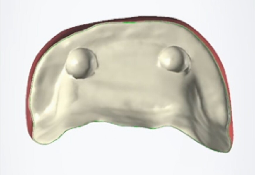 Fig. 15d: The internal surface with the corresponding pin spaces.