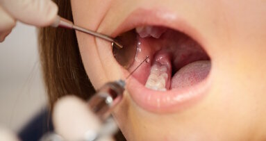 Frustrated with failing local anaesthesia?