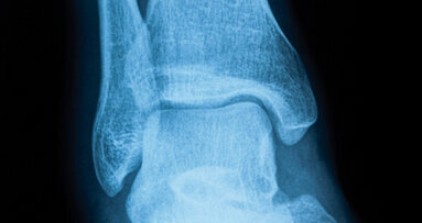 L'avenir offrira des os à la demande et sur mesure