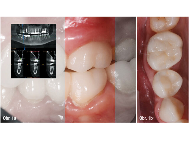 Klinické vyšetření