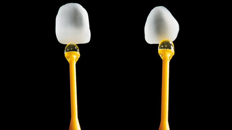 Digitální versus konvenční přístup v estetické stomatologii