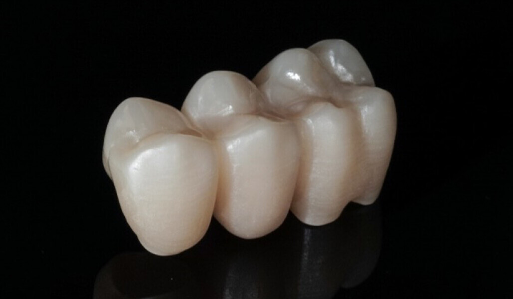 Fig. 9: Bridge made from KATANA Zirconia STML, sandblasted and occlusally polished. 