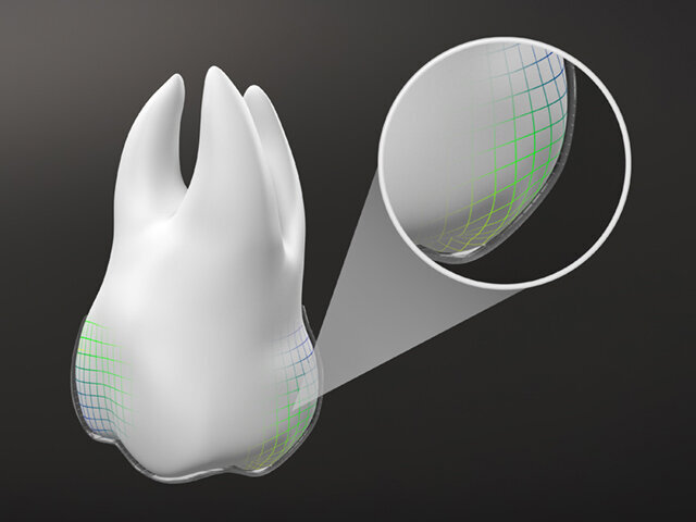 Ilustrační obrázek (Align Technology)