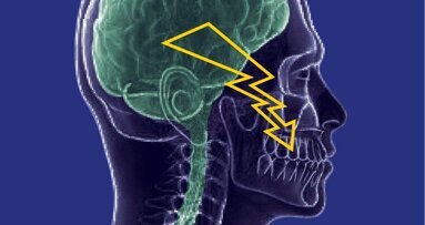 Pesquisadores a desenvolvem tratamento para dor do nervo que afetam os dentes e o rosto