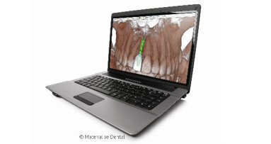 SimPlant® 15 - Maggiore predicibilità della procedura chirurgica e della ricostruzione protesica