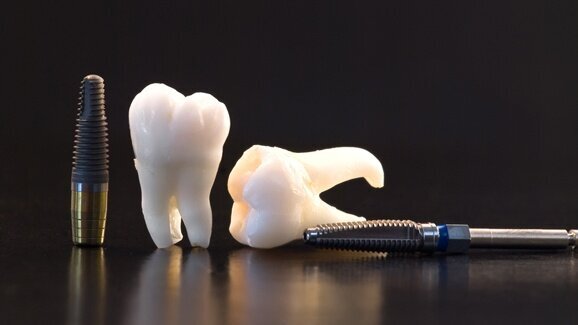 Naukowcy z Podlasia opracowują nowe implanty stomatologiczne