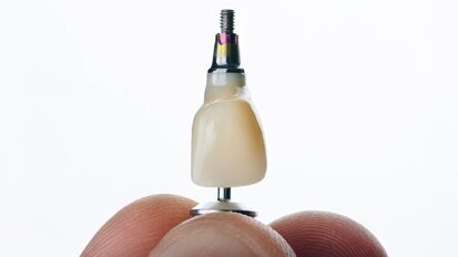 Veel enkelvoudige implantaten functioneren ook na veertig jaar nog