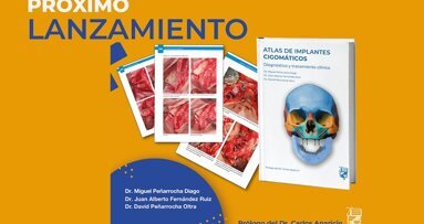 Nuevo “Atlas de implantes cigomáticos”