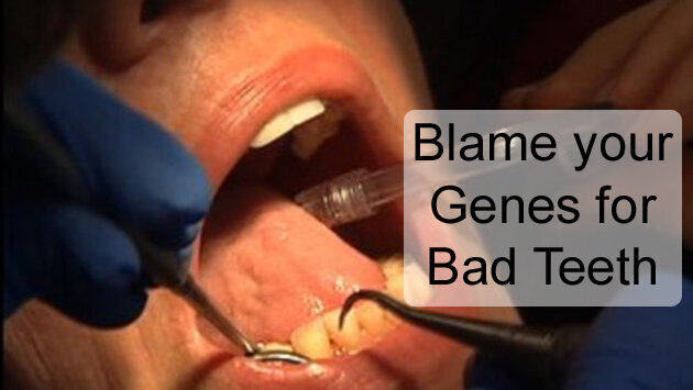 Blame your Genes for Bad Teeth