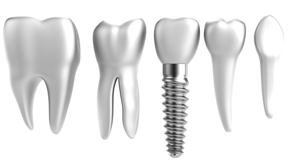 Zahnersatz: Dank Silber weniger Entzündungsreaktionen