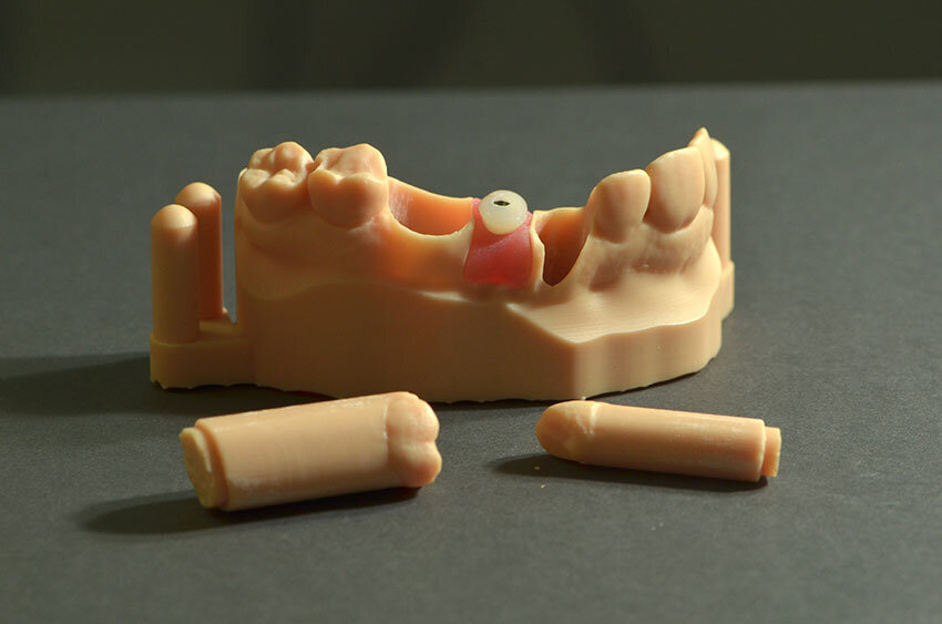 Fig. 15_Il modello master prototipato stampato XFAB 2500PD e analogo digitale in posizione.